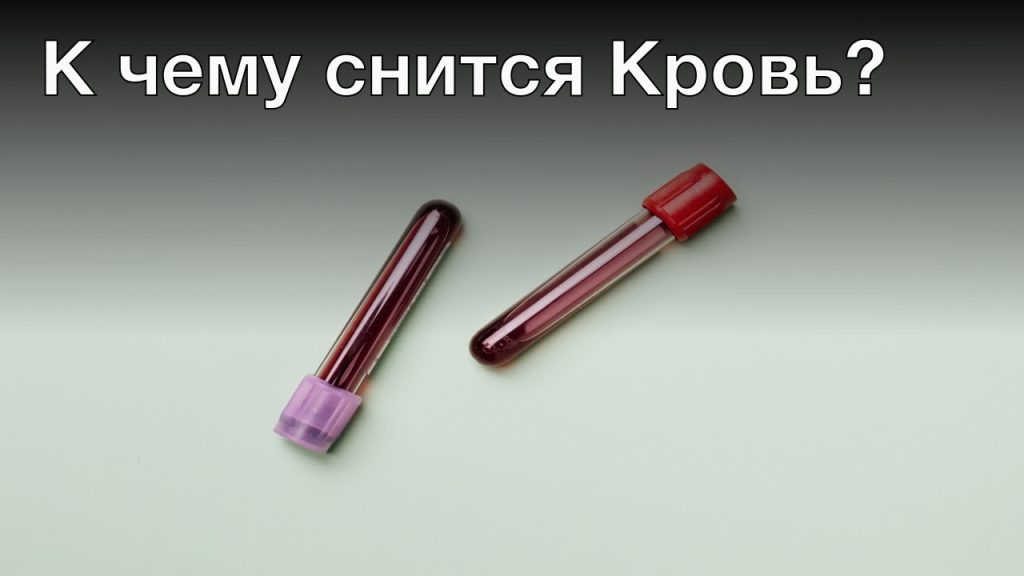К Чему Снится Кровь: Толкования и Значения Сновидений